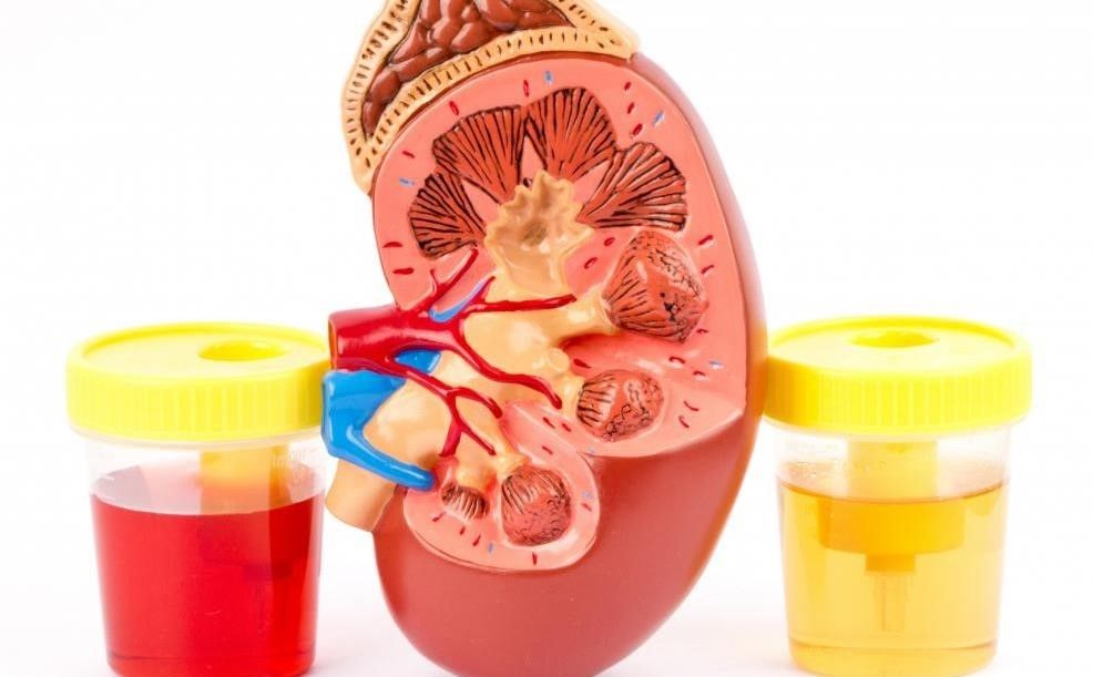 Кровь в моче у ребенка. Почему такое бывает? Что делать?
